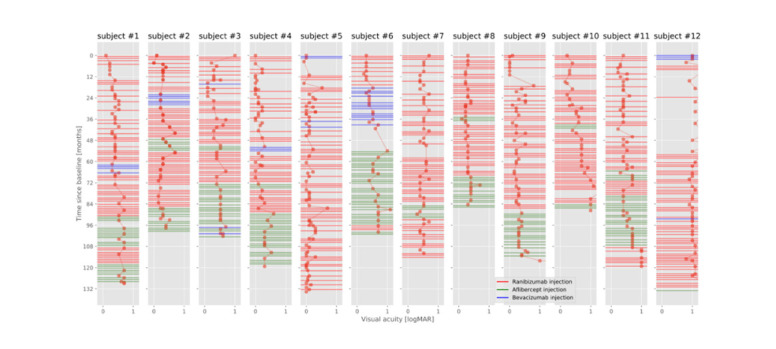 Baseline characteristics and progression of neovascular age-related macular degeneration in patients receiving over 60 intravitreal injections of anti-vascular endothelial growth factor.