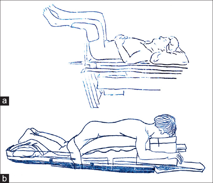 Effect of patient positioning on anesthesiologic risk in endourological procedures.