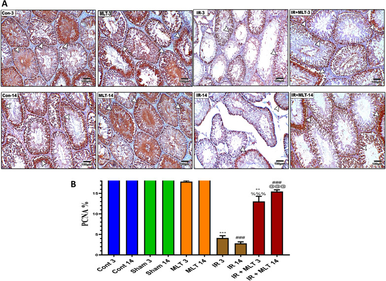 Correction: Utility of melatonin in mitigating ionizing radiation‑induced testis injury through synergistic interdependence of its biological properties.