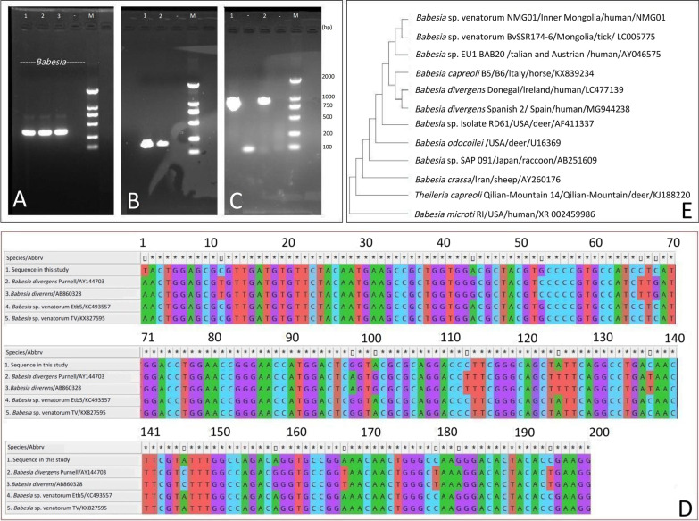 Successful treatment with doxycycline monotherapy for human infection with Babesia venatorum (Babesiidae, Sporozoa) in China: a case report and proposal for a clinical regimen.