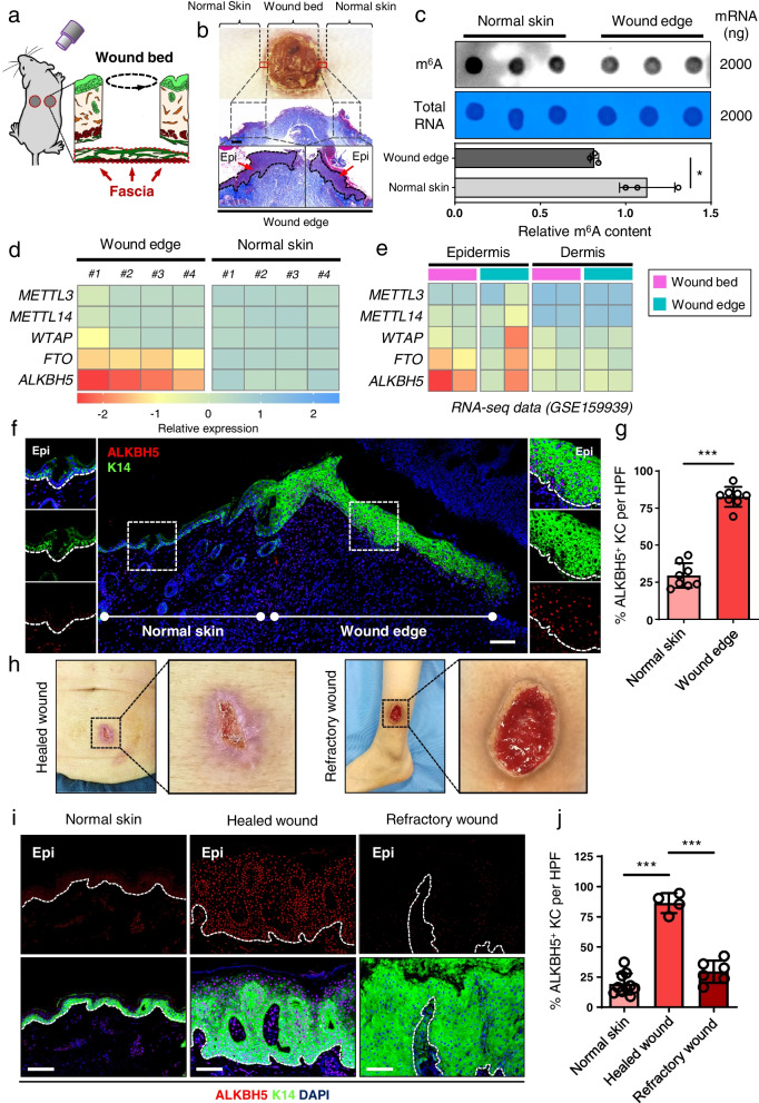 ALKBH5-mediated m<sup>6</sup>A demethylation fuels cutaneous wound re-epithelialization by enhancing PELI2 mRNA stability.