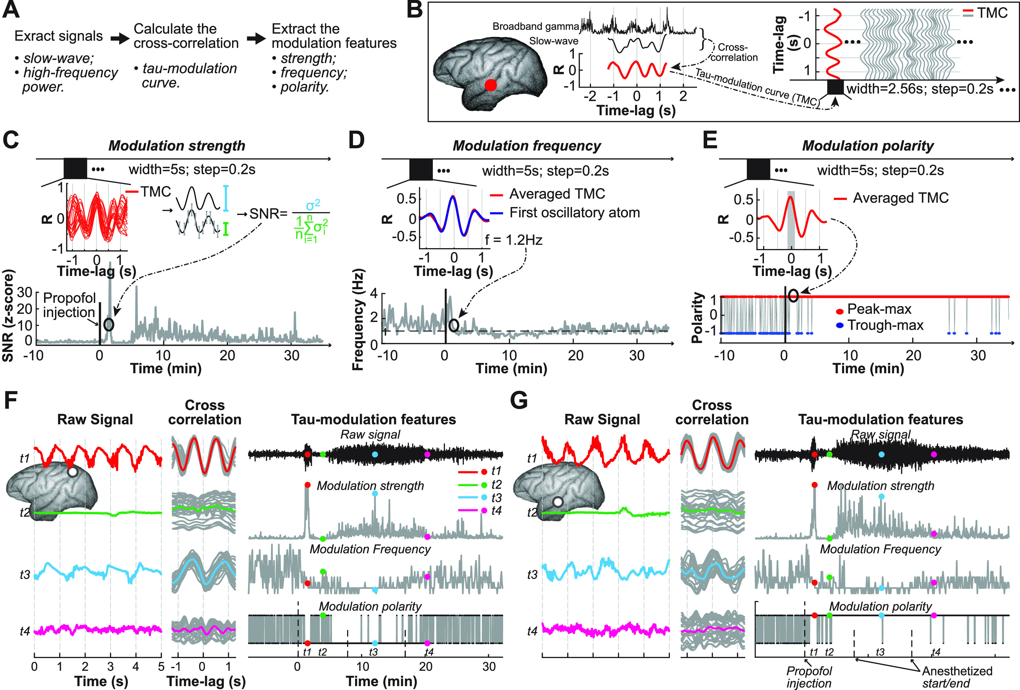 Slow-wave modulation analysis during states of unconsciousness using the novel tau-modulation method.