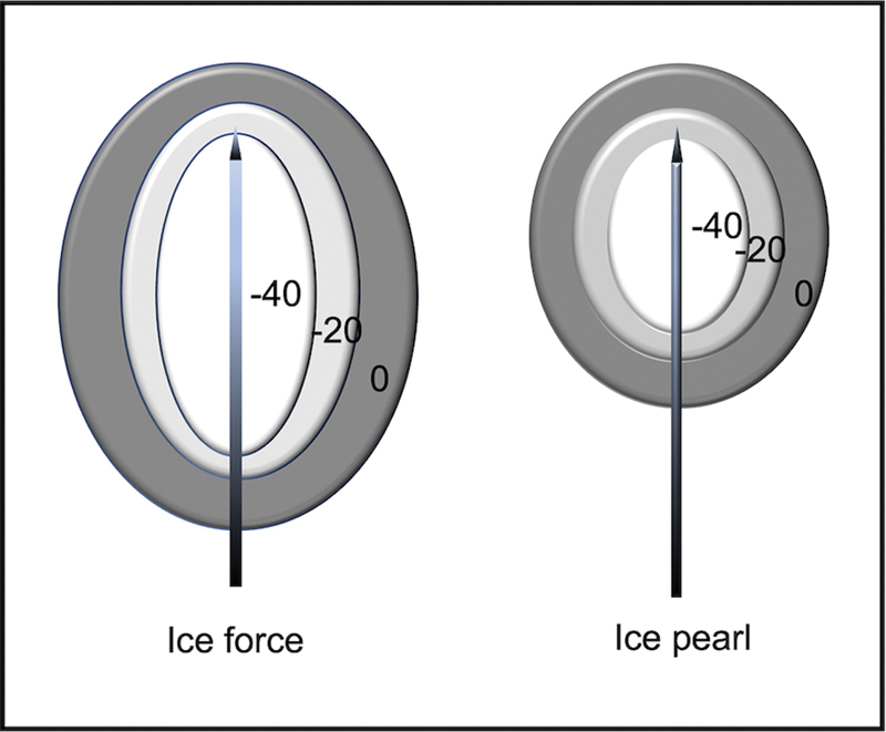 Measurement Analysis of Ice Ball Size during CT-Guided Cryoablation Procedures for Better Prediction of Final Ice Ball Size and Avoidance of Complications.