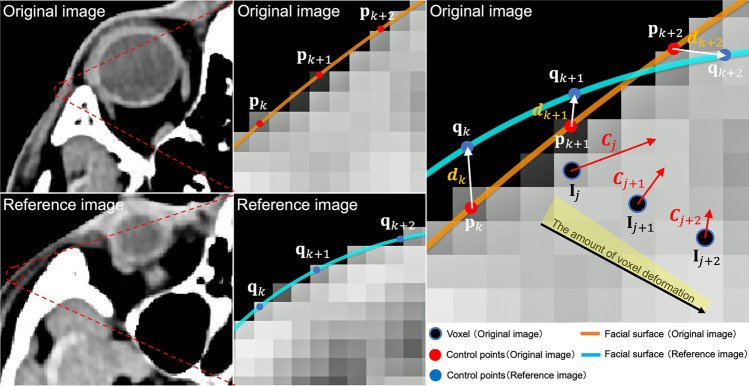 De-Identification Technique with Facial Deformation in Head CT Images.