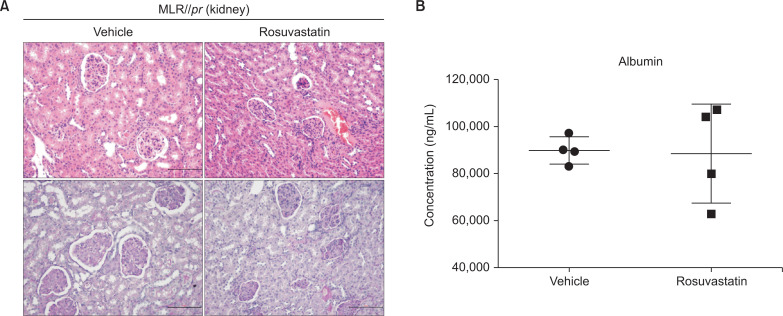 Rosuvastatin treatment alone cannot alleviate lupus in murine model: a pilot study.