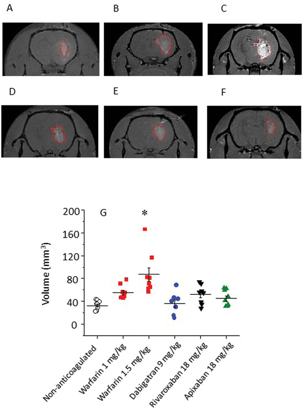 A Combination of Ex Vivo and In Vivo Strategies for Evaluating How Much New Oral Anticoagulants Exacerbate Experimental Intracerebral Bleeding.