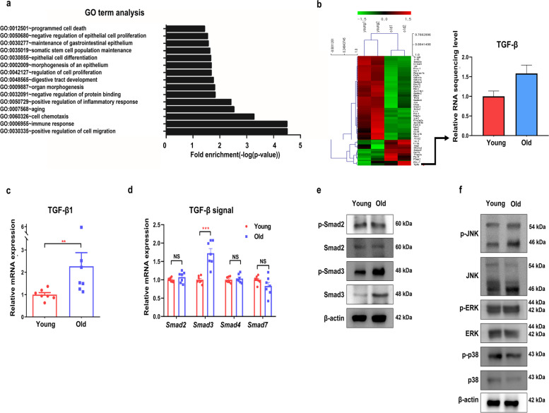 Effect of aging on the formation and growth of colonic epithelial organoids by changes in cell cycle arrest through TGF-β-Smad3 signaling.