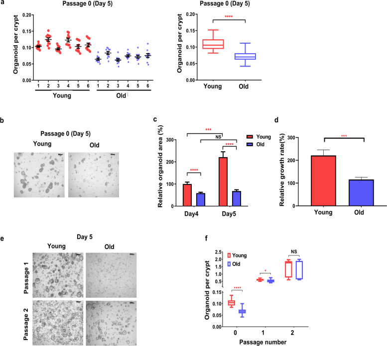 Effect of aging on the formation and growth of colonic epithelial organoids by changes in cell cycle arrest through TGF-β-Smad3 signaling.