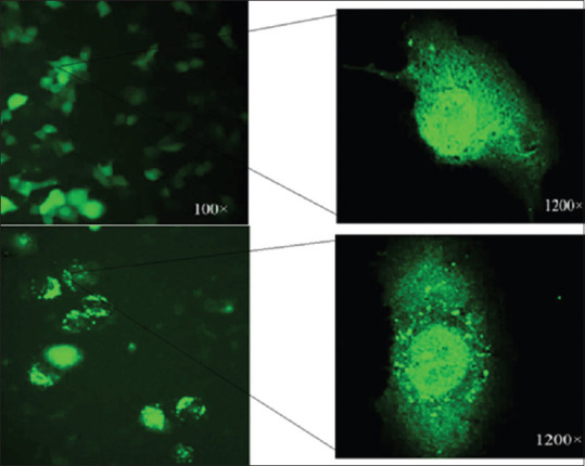 Preventive treatment of coronavirus disease-2019 virus using coronavirus disease-2019-receptor-binding domain 1C aptamer by suppress the expression of angiotensin-converting enzyme 2 receptor.