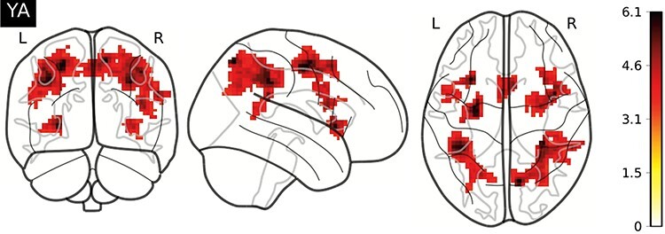 Age-related differences in interference control in the context of a finger-lifting task: an fMRI study.