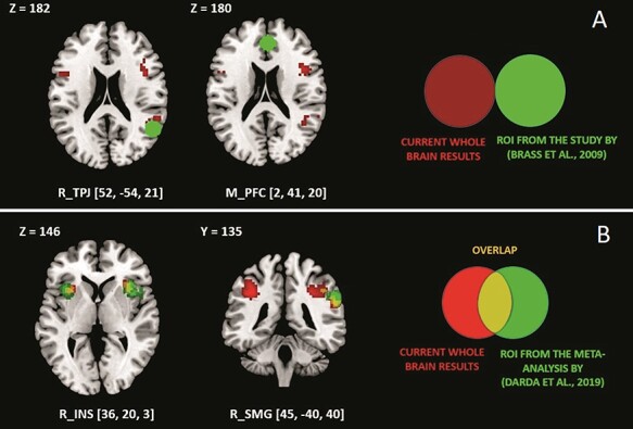 Age-related differences in interference control in the context of a finger-lifting task: an fMRI study.