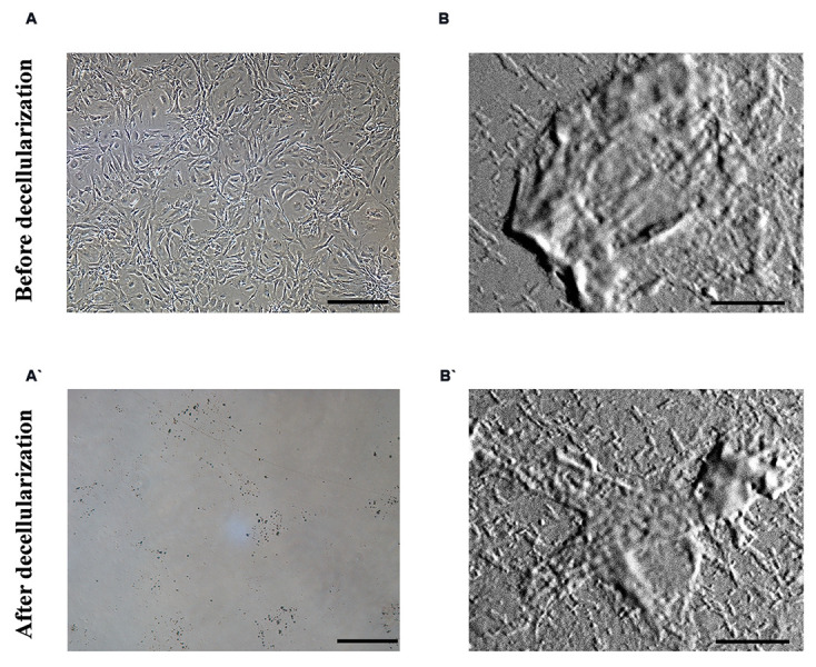 Mouse Embryonic Fibroblasts-Derived Extracellular Matrix Facilitates Expansion of Inner Ear-Derived Cells.