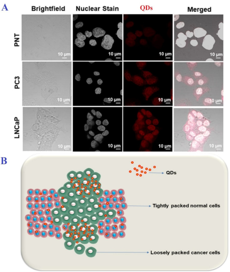 Biosynthesis of Quantum Dots and Their Therapeutic Applications in the Diagnosis and Treatment of Cancer and SARS-CoV-2.