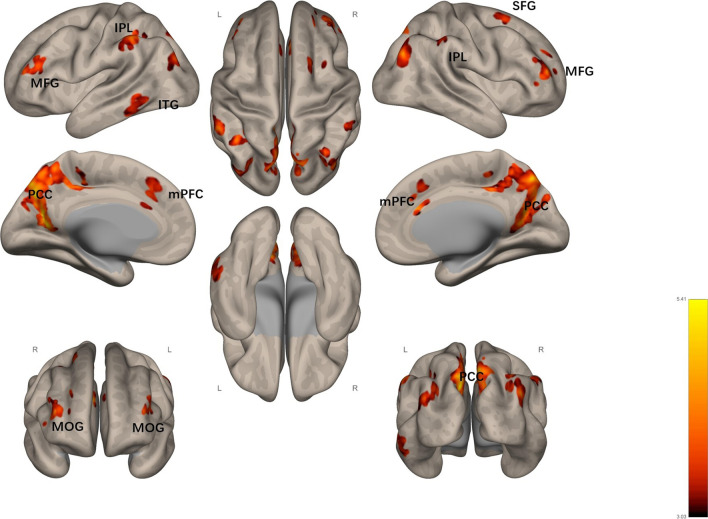 The mediating role of default mode network during meaning-making aroused by mental simulation between stressful events and stress-related growth: a task fMRI study.