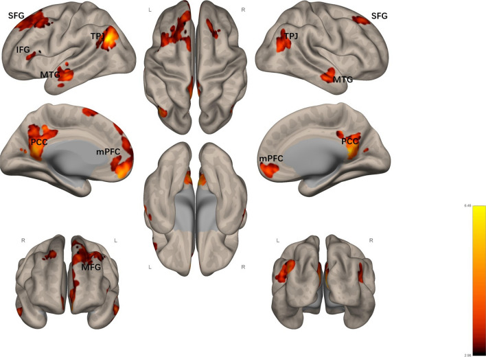 The mediating role of default mode network during meaning-making aroused by mental simulation between stressful events and stress-related growth: a task fMRI study.