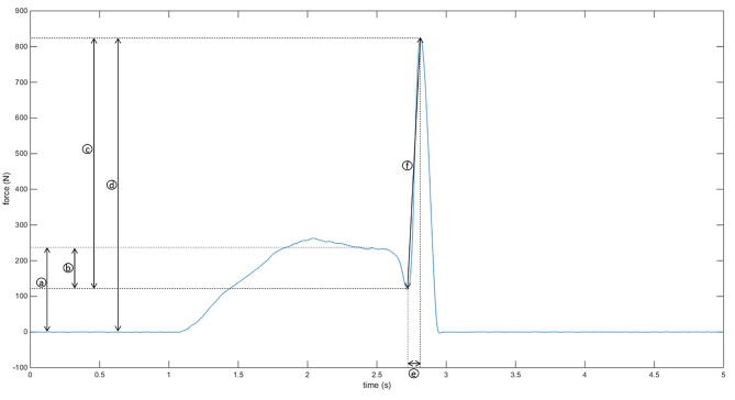 Investigating force-time characteristics of prone thoracic SMT and self-reported patient outcome measures: a feasibility study.