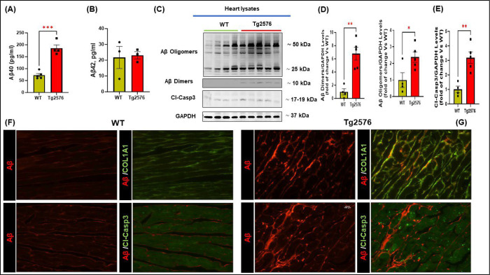 Amyloid β instigates cardiac neurotrophic signaling impairment, driving Alzheimer's associated heart disease.