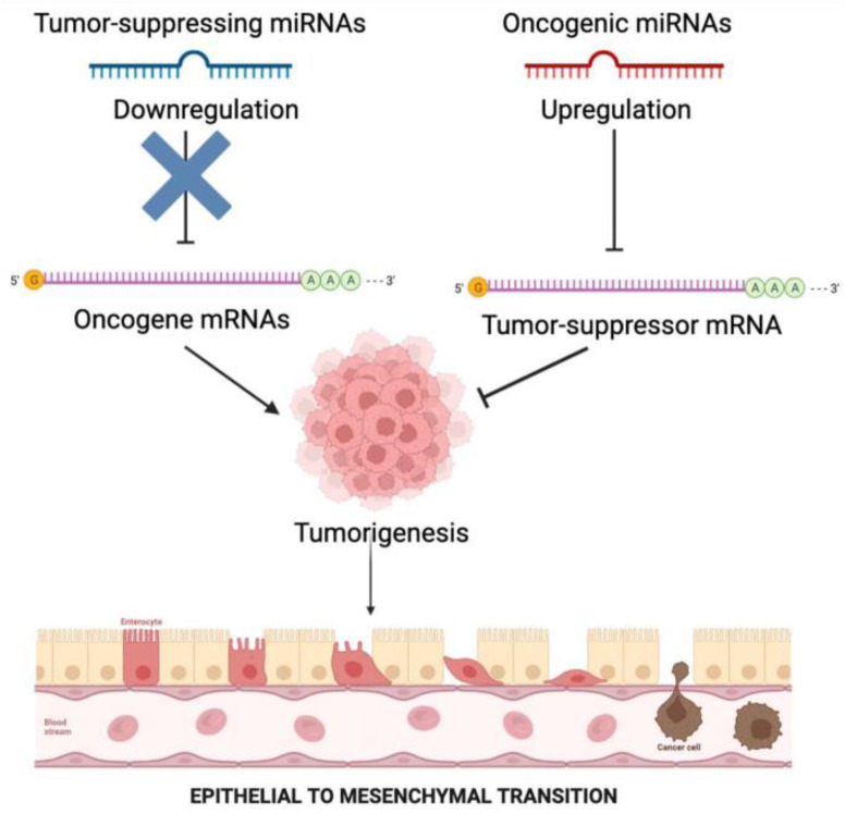 The Role of MicroRNAs in Development of Endometrial Cancer: A Literature Review.