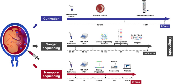 Rapid diagnosis of intra-amniotic infection using nanopore-based sequencing.