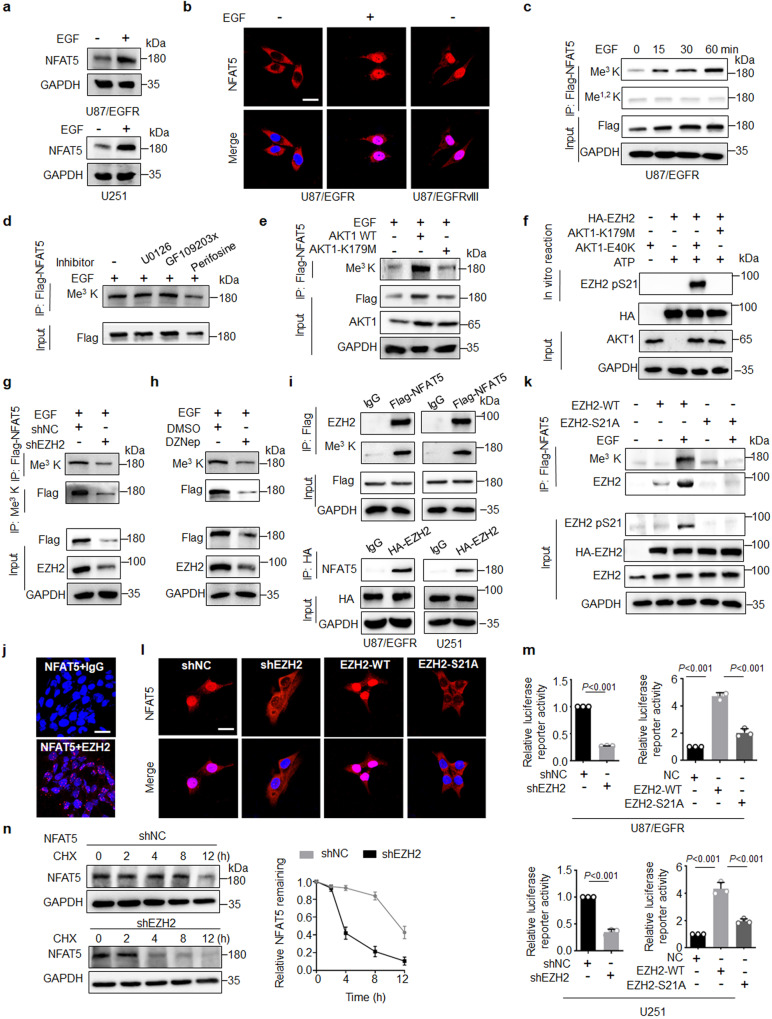 Lysine methylation promotes NFAT5 activation and determines temozolomide efficacy in glioblastoma.