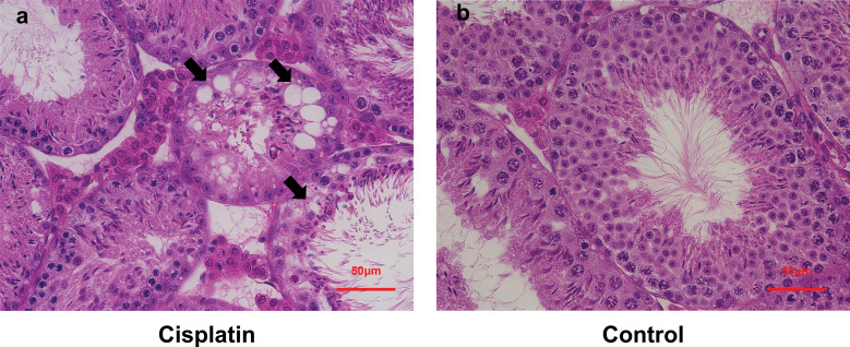 Creatine Chemical Exchange Saturation Transfer (Cr-CEST) Imaging Can Evaluate Cisplatin-induced Testicular Damage.