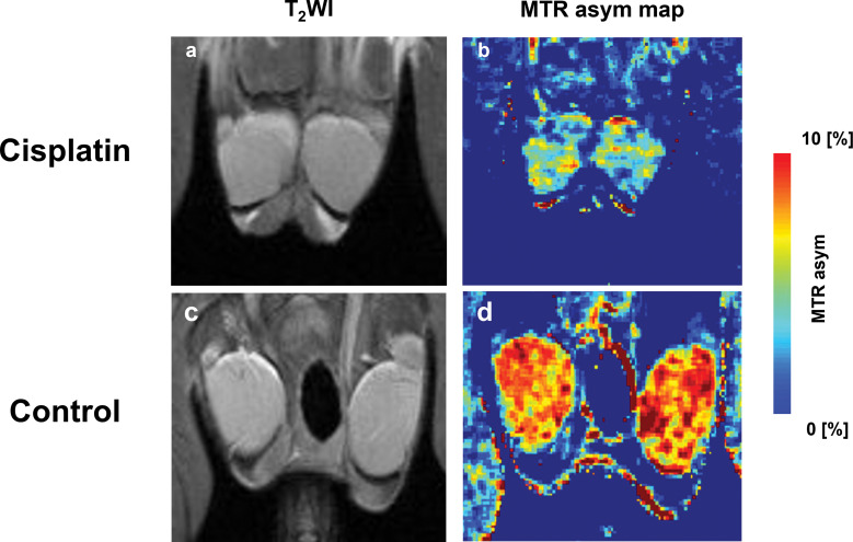 Creatine Chemical Exchange Saturation Transfer (Cr-CEST) Imaging Can Evaluate Cisplatin-induced Testicular Damage.