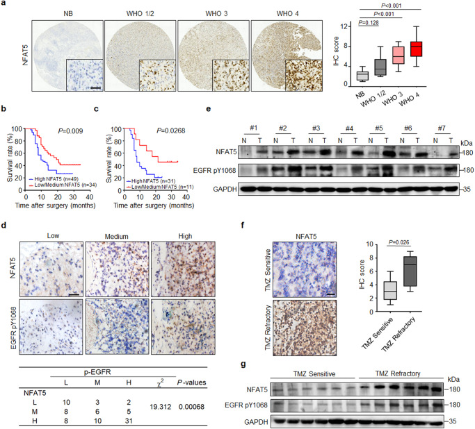 Lysine methylation promotes NFAT5 activation and determines temozolomide efficacy in glioblastoma.