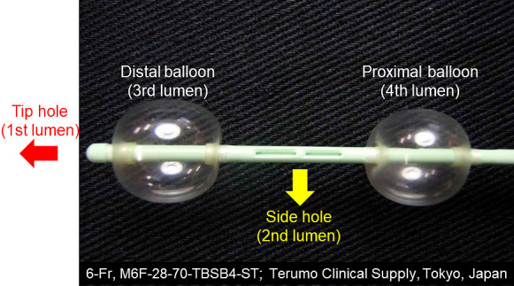 Detection of the Vesical Arteries Using Three-dimensional Digital Subtraction Angiography Relevant to Intra-arterial Infusion Chemotherapy for Bladder Cancer Using Double-balloon Catheters.