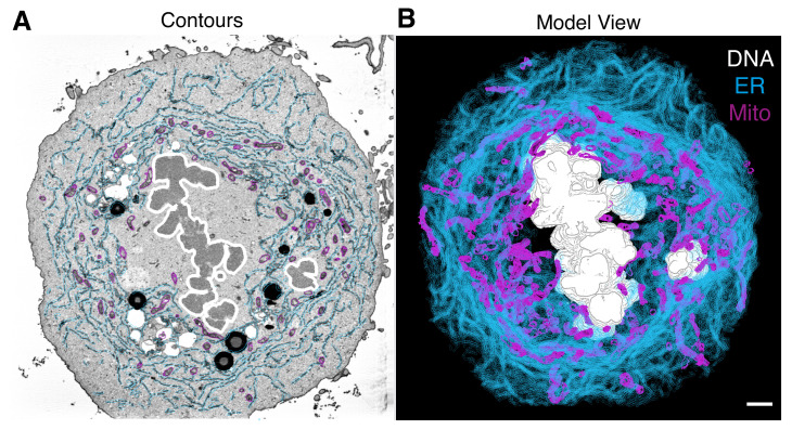 3D Ultrastructural Visualization of Mitosis Fidelity in Human Cells Using Serial Block Face Scanning Electron Microscopy (SBF-SEM).