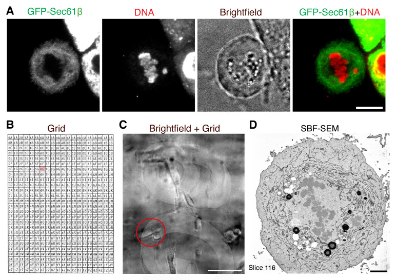 3D Ultrastructural Visualization of Mitosis Fidelity in Human Cells Using Serial Block Face Scanning Electron Microscopy (SBF-SEM).