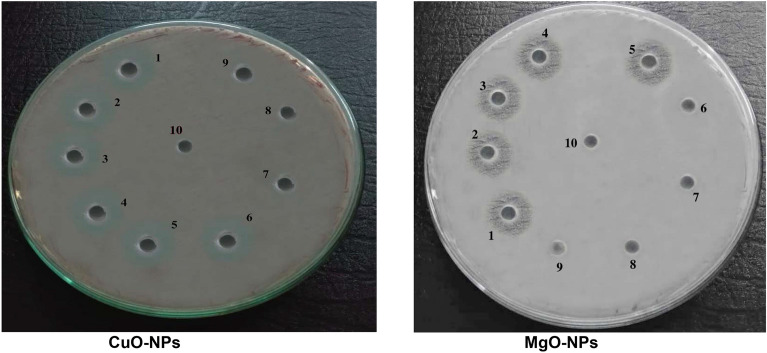 Management of potato brown rot disease using chemically synthesized CuO-NPs and MgO-NPs.