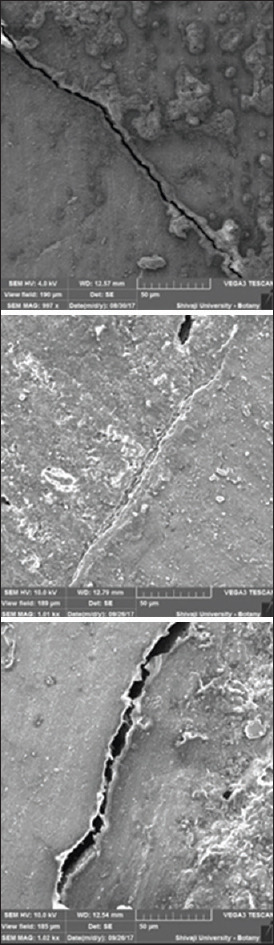 Comparative evaluation of marginal adaptation of mineral trioxide aggregate, Biodentine, and geristore as a root end filling material: An <i>in vitro</i> scanning electron microscope study.