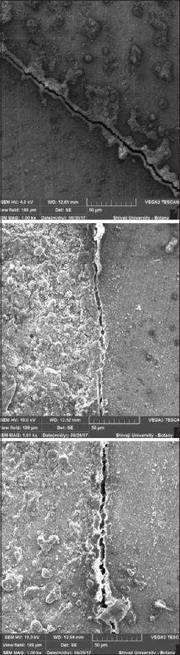 Comparative evaluation of marginal adaptation of mineral trioxide aggregate, Biodentine, and geristore as a root end filling material: An <i>in vitro</i> scanning electron microscope study.