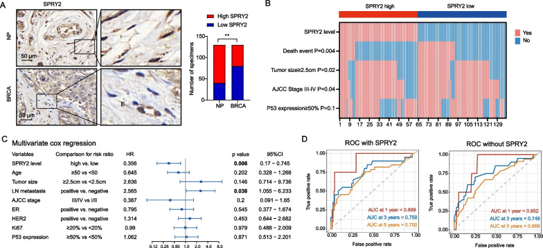 Loss of SPRY2 contributes to cancer-associated fibroblasts activation and promotes breast cancer development.