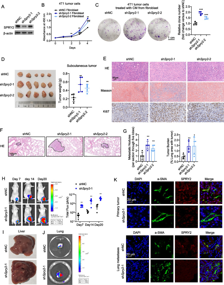 Loss of SPRY2 contributes to cancer-associated fibroblasts activation and promotes breast cancer development.