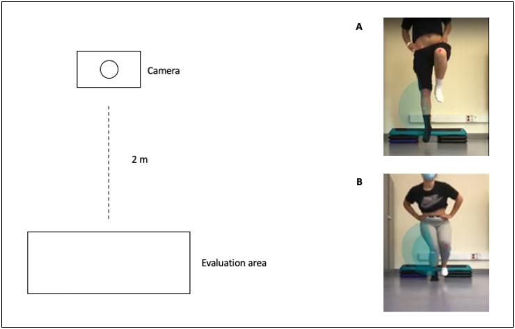 Assessing the effect of prophylactic ankle taping on ankle and knee biomechanics during landing tasks in healthy individuals: A cross-sectional observational study.