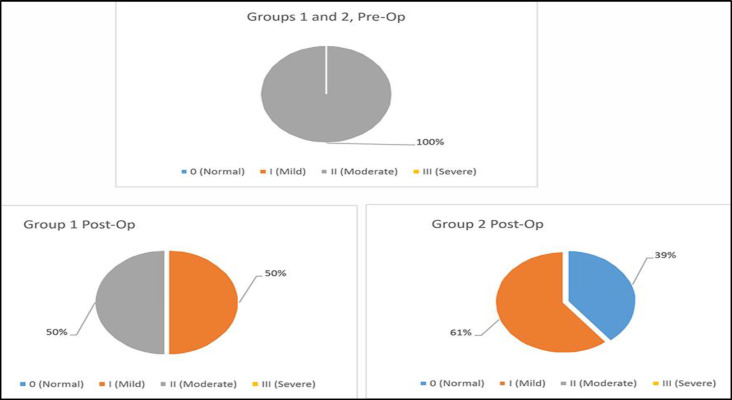 Effectiveness of Uvulopalatoplasty and Nasal Surgery in OSAS Patients.