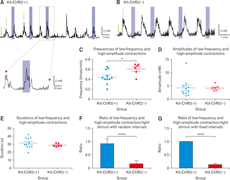 An Optogenetics-based Approach to Regulate Colonic Contractions by Modulating the Activity of the Interstitial Cells of Cajal in Mice.