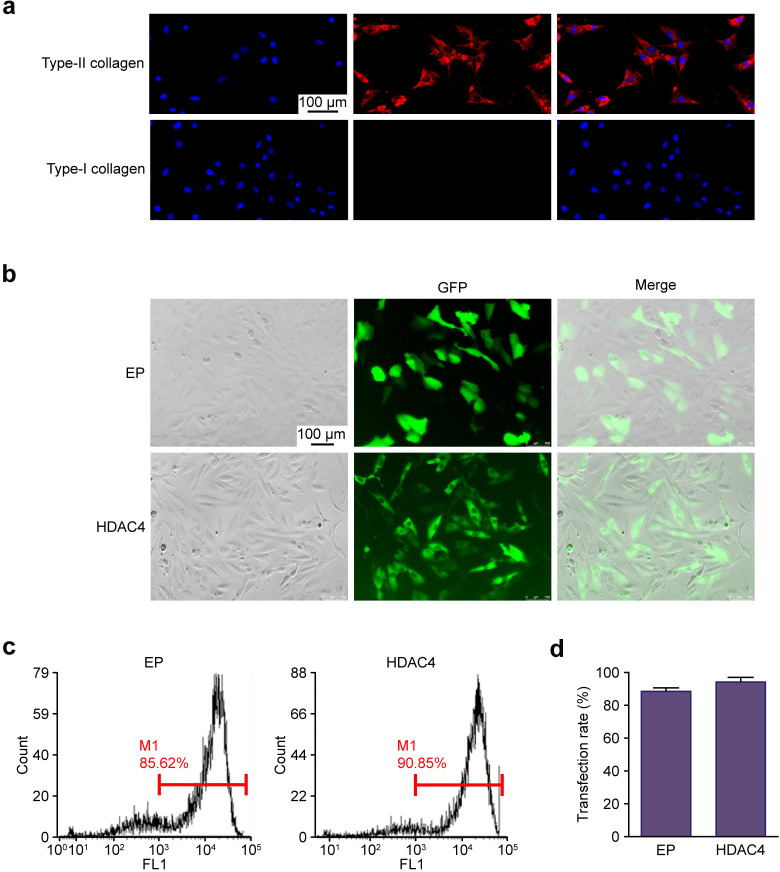 Upregulated ribosome pathway plays a key role in HDAC4, improving the survival rate and biofunction of chondrocytes.