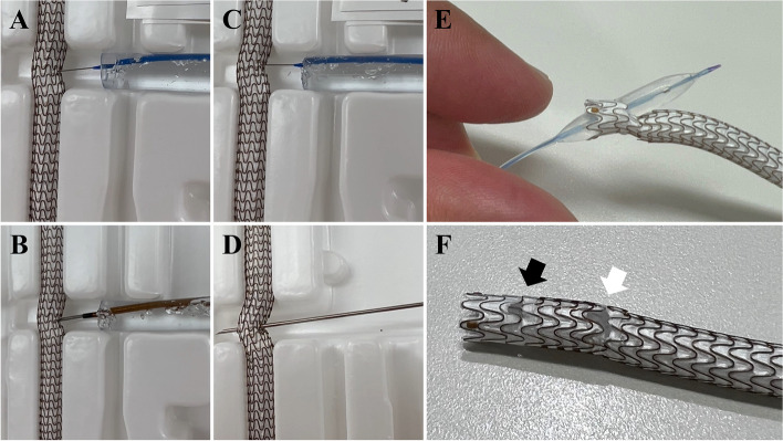 The ViaHole technique: a novel approach for recanalizing major side branch occluded by Viabahn stent-graft.