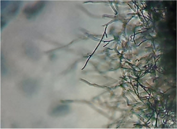 Characterization of biologically active exopolysaccharide produced by Streptomyces sp. NRCG4 and its anti-Alzheimer efficacy: in-vitro targets.