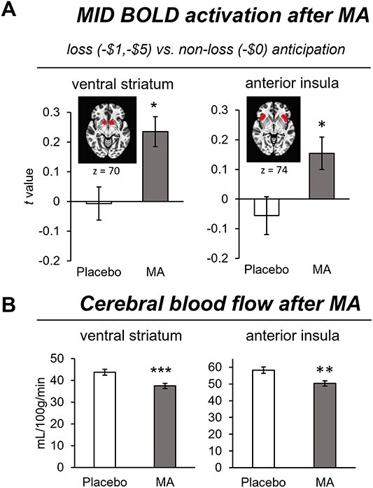 Methamphetamine enhances neural activation during anticipation of loss in the monetary incentive delay task.