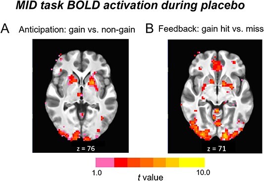 Methamphetamine enhances neural activation during anticipation of loss in the monetary incentive delay task.