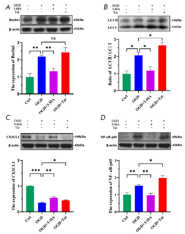 Attenuating Neuronal Autophagy Alleviates Inflammatory Injury in OGDDeprived Co-culture of HT22 with BV2.