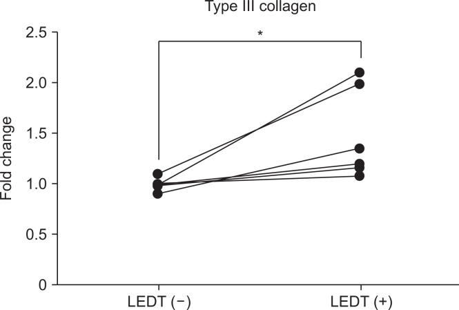 Effects of light-emitting diode therapy on hand stiffness and pain in non-steroidal anti-inflammatory drug-refractory patients with tenosynovitis.