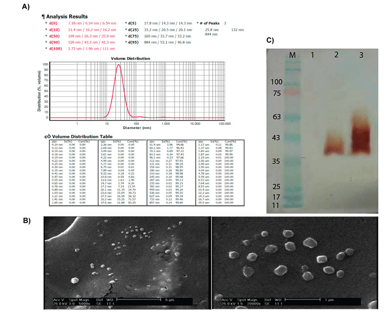 The Effect of Collagen and Fibrin Hydrogels Encapsulated with Adipose Tissue Mesenchymal Stem Cell-Derived Exosomes for Treatment of Spinal Cord Injury in a Rat Model.