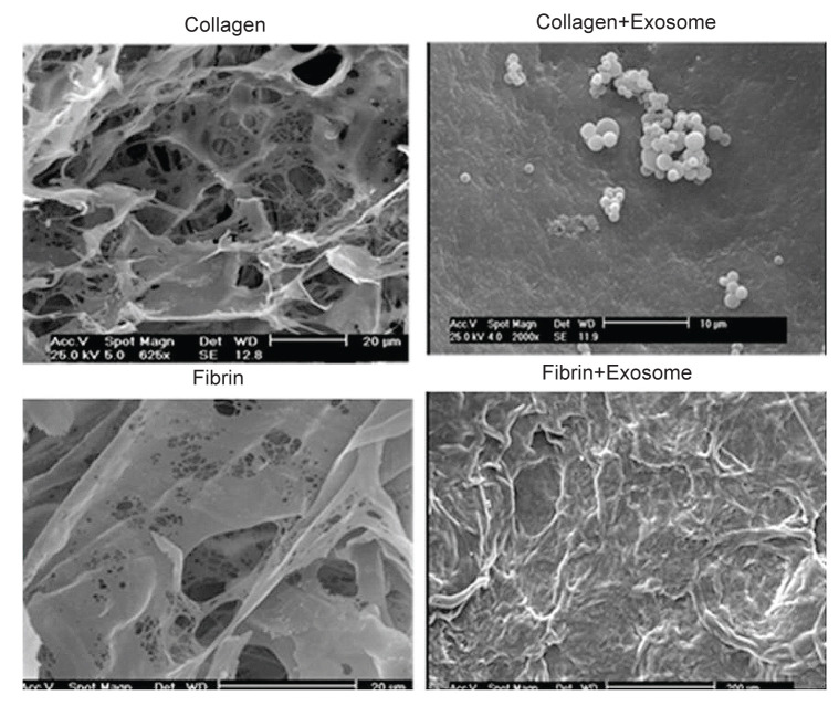 The Effect of Collagen and Fibrin Hydrogels Encapsulated with Adipose Tissue Mesenchymal Stem Cell-Derived Exosomes for Treatment of Spinal Cord Injury in a Rat Model.