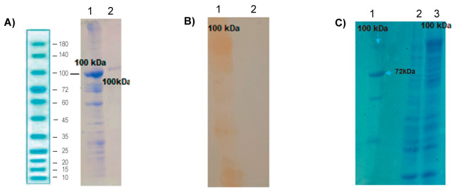 <i>In vitro</i> Gluten Degradation Using Recombinant Eurygaster Integriceps Prolyl Endoprotease: Implications for Celiac Disease.