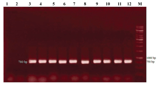 Anti-Inflammatory Properties of Extract of the Hairy Root of Native <i>Portulaca Oleracea</i> L. and Its Effect on Some Inflammatory Genes Expression in Rat Microglial Cells.