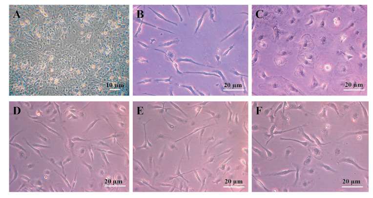 Anti-Inflammatory Properties of Extract of the Hairy Root of Native <i>Portulaca Oleracea</i> L. and Its Effect on Some Inflammatory Genes Expression in Rat Microglial Cells.